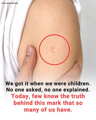 The Truth Behind the Mysterious Round Scar on the Upper Arm
