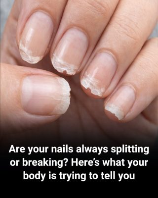 Weak or Brittle Nails: What Your Body Is Trying to Tell You