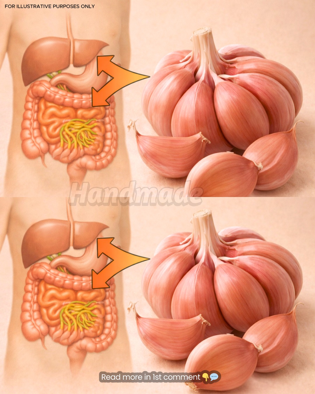 What Happens When You Eat Raw Garlic?
