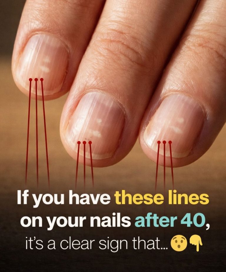 Foods That Support Stronger Nails After 40