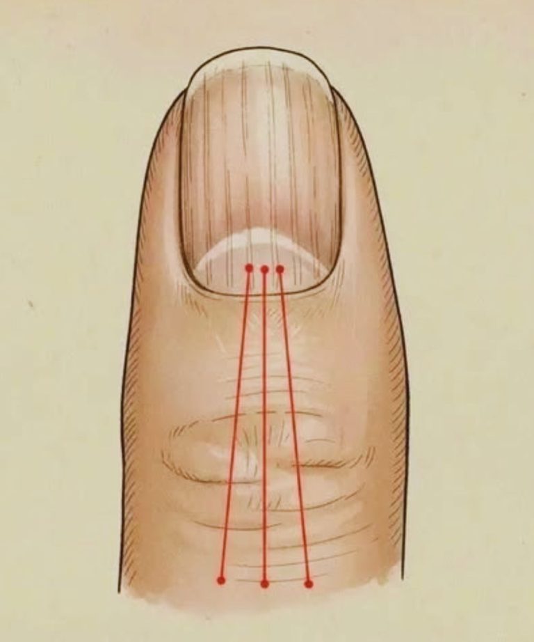 What to Eat to Reduce Nail Ridges: A Nutrition Guide for Healthier Nails